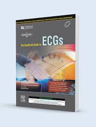 The Unofficial Guide to ECGs