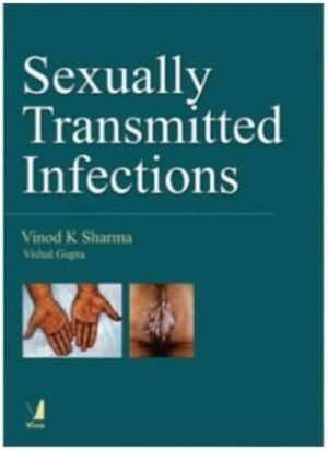 Sexually Transmitted Infections